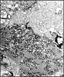 This transmission electron micrograph (TEM) revealed the presence of numerous dark, bullet-shaped rabies virions within an infected tissue sample.