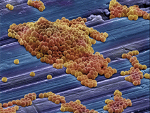 Scanning electron micrograph shows clusters of spherical staph bacteria.