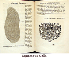 Anatomia et contemplatio nonnullorum naturae invisibilium secretorum comprehensorum epistolis quibusdam scriptis ad ... Societatis Regiae Londinensis Collegium by Antoni van Leeuwenhœk, Leiden, 1685