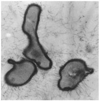 Cross section of Actinomyces naeslundii showing the presence of cell surface fimbriae on this gram-positive oral microorganism