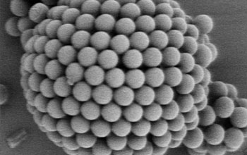 electron microscope image of a colloidosome