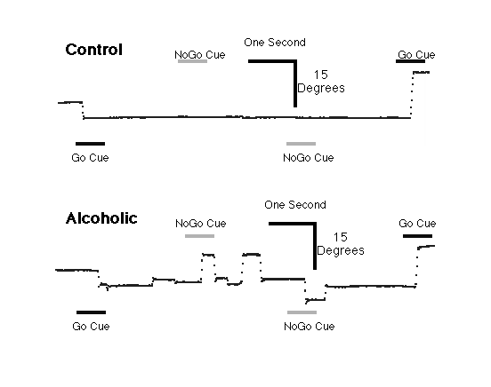 Performance examples of a control subject and an alcoholic patient on the go/no-go task