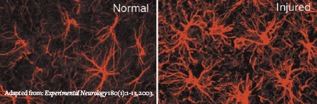 AFTER SPINAL CORD DAMAGE, GLIAL CELLS CALLED ASTROCYTES PROLIFERATE AND EXPAND - Glial Cells Photo