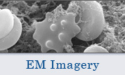 electron micrograph image