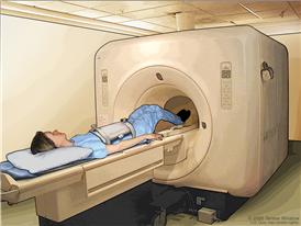 Imaginología por resonancia magnética (IRM) del abdomen; el dibujo muestra al paciente en una camilla que se desliza hacia la máquina de IRM, la cual toma una radiografía de la parte interior del cuerpo.  La almohadilla en el abdomen del paciente ayuda a tomar imágenes más claras.