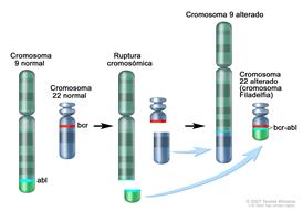 Cromosoma Filadelfia; los tres paneles del dibujo muestran una sección del cromosoma 9 y una sección del cromosoma 22 que se rompen e intercambian lugares, creando un cromosoma 22 alterado llamado cromosoma Filadelfia. En el panel izquierdo, el dibujo muestra el cromosoma 9 normal con el gen abl y el cromosoma 22 normal con el gen bcr. En el panel del centro, el dibujo muestra el cromosoma 9 que se separa a la altura del gen abl y el cromosoma 22 que se separa por debajo del gen bcr. En el panel de la derecha, el dibujo muestra el cromosoma 9 unido a la sección del cromosoma 22 y el cromosoma 22 con la sección del cromosoma 9 que contiene parte del gen abl unido a él. El cromosoma 22 alterado con el gen abl-bcr se llama cromosoma Filadelfia.