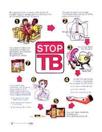 Stop TB poster
