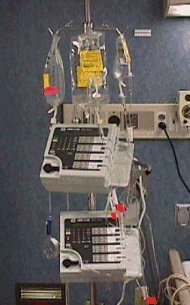Muti-channel infusion pump for delivery of chemotherapy