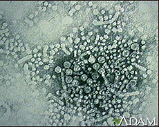 Photograph of an electronmicroscopic image of hepatitis B virus particles