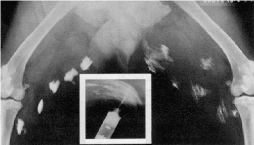 X-ray showing autoinjector effectiveness