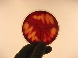The bacterial pathogen Streptococcus iniae grows on a blood agar plate. 