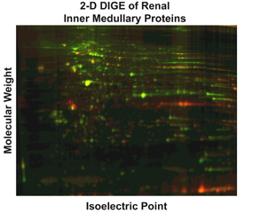 Fluorescence image of 2-dimensional gel showing response of proteome of rat inner medullary collecting duct to long-term vasopressin treatment.