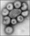 This negative-stained transmission electron micrograph (TEM) depicts the ultrastructural details of a number of influenza virus particles, or “virions”. A member of the taxonomic family Orthomyxoviridae, the influenza virus is a single-stranded RNA organism.