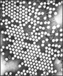Electron micrograph of the poliovirus.