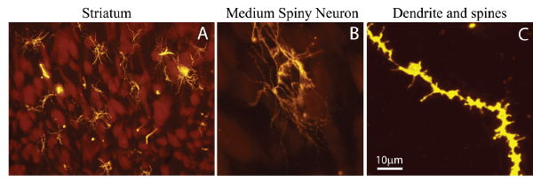 Image of 3 panels with increasing magnification. Panel A shows striatum with stained medium spiny neurons, panel B a single medium spiny neuron and panel C a section of the neurons dendrite with clearly visible spines.