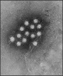 An electron micrograph of the Hepatitis A virus (HAV), an RNA virus that can survive up to a month at room temperature.