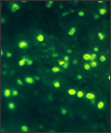 Photomicrograph of Haemophilus influenzae using immunofluorescence.