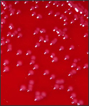 This blood agar culture is growing colonies of Corynebacterium diphtheria var. belfanti bacteria.