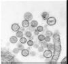 Thin-section electron micrograph of Sin Nombre virus isolate