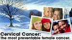 Cervical Cancer