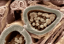 Cross-section of 2 nerve fibers with thick sheaths.