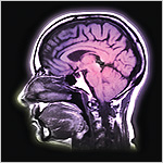 cross-sectional image of head and brain