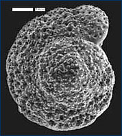 electron micrograph of a foraminiferan