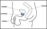Medical illustration: Prostate location 
