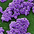 The spores of anthrax-causing bacteria (purple) can live dormant for many years. Courtesy of Janice Haney Carr, CDC.