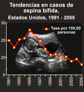 Tendencias en casos de espina bífida. Estados Unidos, 1991 - 2005