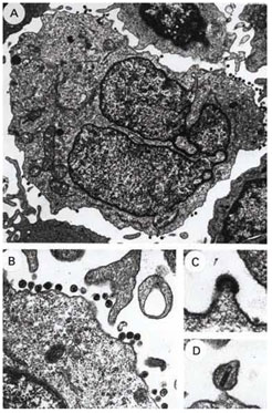 Images of Blood Leukocytes from an AIDS Patient Producing HIV