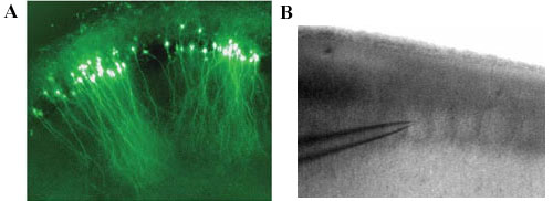 Viral expression in a hippocampal slice and visualisation of barrels in a neocortical brain slice 