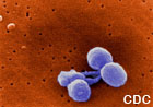 Pneumonia Hospitalizations Among Young Children Before and After Introduction of Pneumococcal Conjugate Vaccine --- United States, 1997 -- 2006