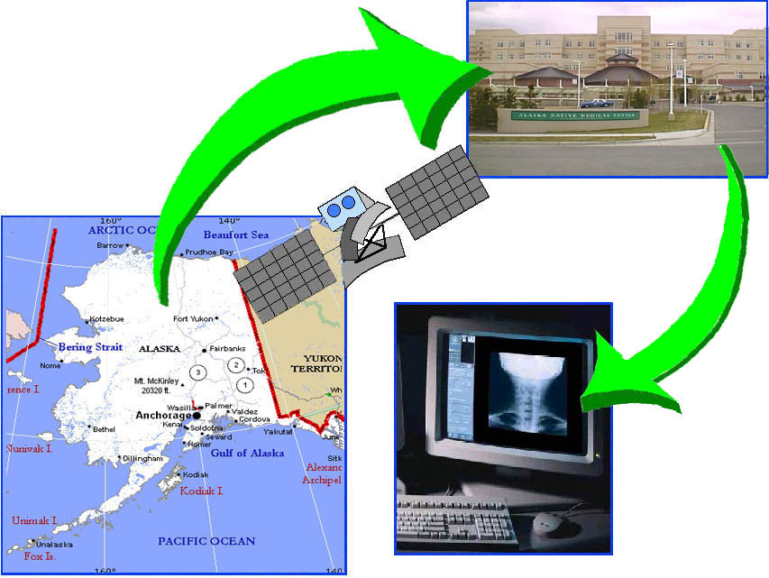 Hypothetical telemedicine transmission scenarios, from Alaska to a satallite in the sky, beamed down to IHS hospital and over to the desk of a physician