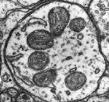 A cell with its energy producing mitochondria.