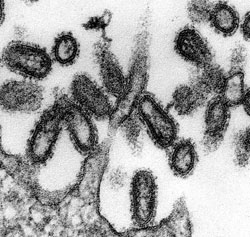 A transmission electron micrograph of an ultra-thin specimen reveals some features seen in 1918 influenza virus virions.