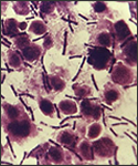 Bacillus anthracis.