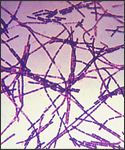A photomicrograph of Bacillus anthracis bacteria using Gram stain technique.