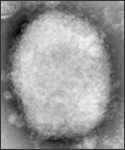 Here a negative stain electron micrograph reveals a “M” (mulberry type) monkeypox virus virion in human vesicular fluid.