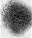 This 1973 negative stained transmission electron micrograph (TEM) depicted the ultrastructural features displayed by the mumps virus.