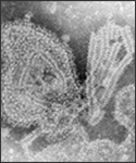 This 1976 negative stained transmission electron micrograph (TEM) depicted the ultrastructural features displayed by the mumps virus.