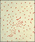 A photomicrograph of Bordetella (Haemophilus) pertussis bacteria using Gram stain technique.
