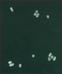 This micrograph depicts Streptococcus pneumoniae bacteria in cerebral spinal fluid using FA staining technique.