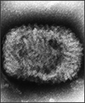 Highly magnified at 310,000X, this negative-stained transmission electron micrograph (TEM) depicted a smallpox (variola) virus particle, or a single “virion”. 