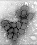 A transmission electron micrograph of smallpox viruses using a negative stain technique.
