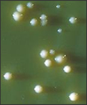 Here a Lowenstein-Jensen plate culture has been inoculated with 15 strains of Mycobacteria spp..