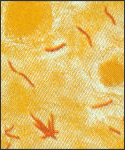 Photomicrograph of a sputum sample containing Mycobacterium tuberculosis.