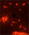 M. tuberculosis in a sputum smear is stained using fluorescent auramine with acridine orange counterstain; Mag.-950x.