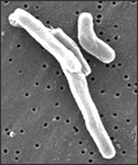 At a magnification of 13172x, this scanning electron micrograph (SEM) depicted a number of Gram-positive Mycobacterium tuberculosis bacteria. As an obligate aerobic organism M. tuberculosis can only survive in an environment containing oxygen. This bacterium ranges in length between 2 - 4µm, and a width between 0.2 - 0.5µm.