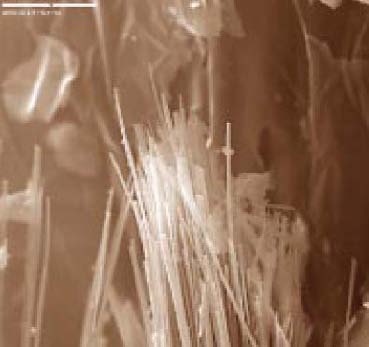 Imagen de microscopio de rastreo electrónico de asbesto en su forma anfíbola